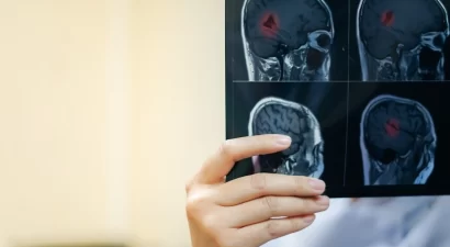 What are the signs of a traumatic brain injury?